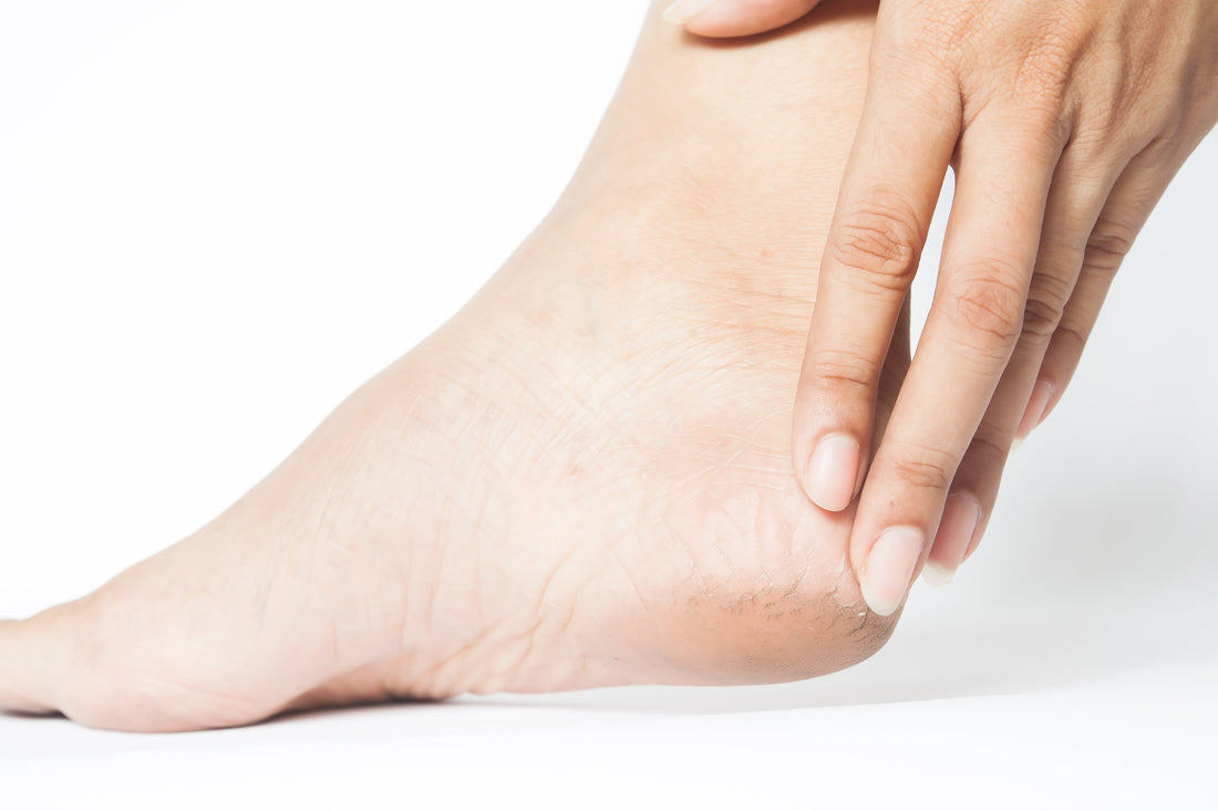 How to Use a Foot Scrub Safely on Dry, Cracked Skin